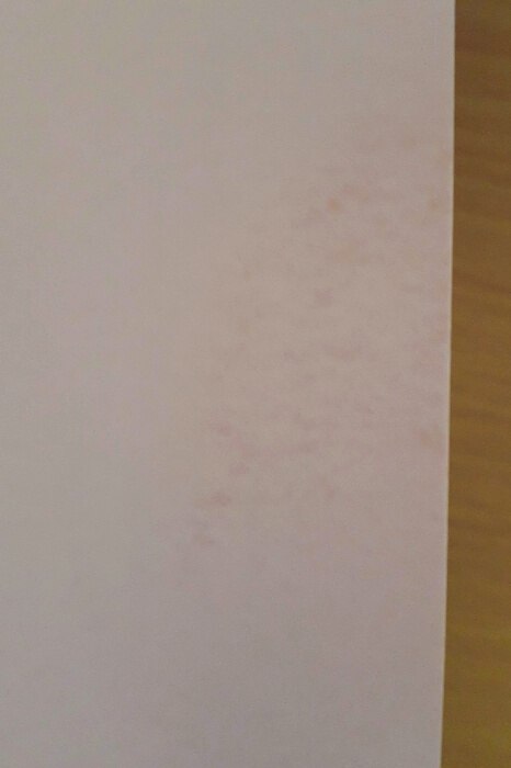 通信指導の無水エタノール後ウラ